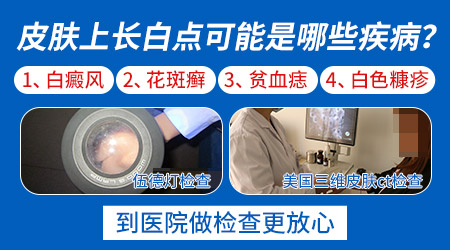 心理干预-白癜风治疗期间如何保持好的心态